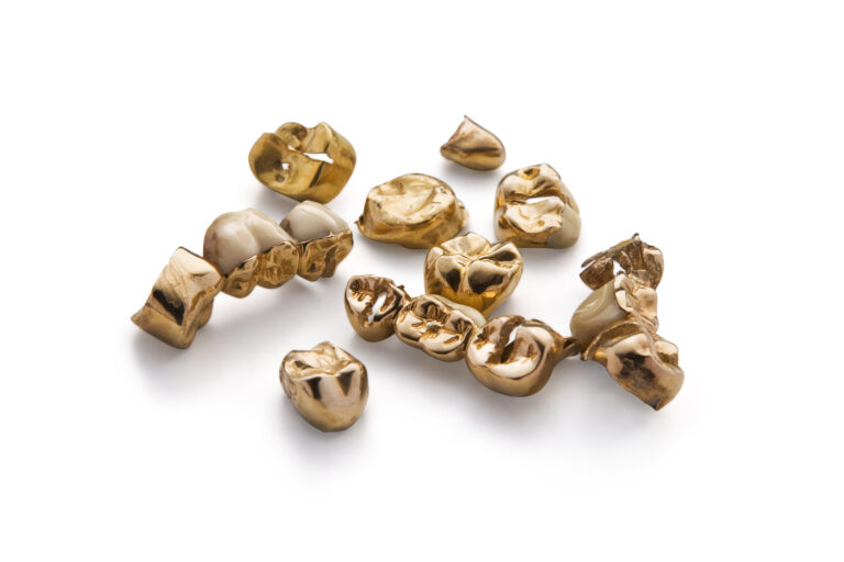 Zahngold vor der Bewertung